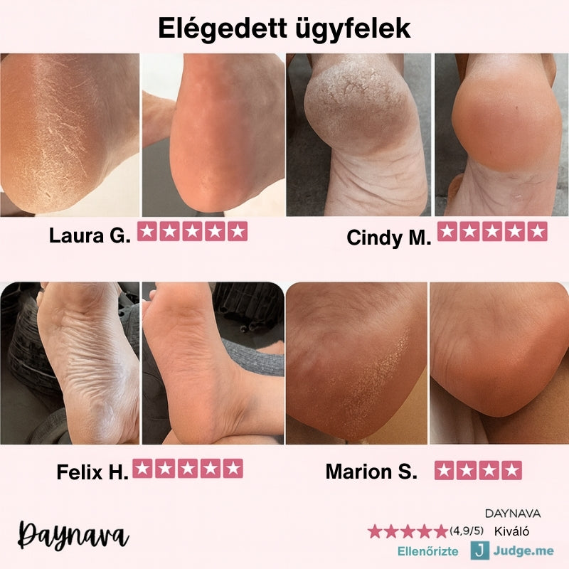 Daynava Elektromos Lábreszelő