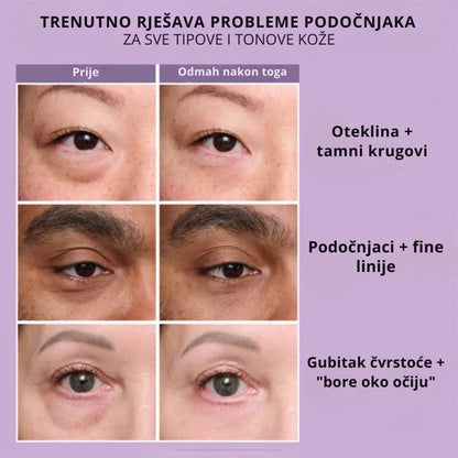 Daynava™ Trenutni Lifter za Oči — Odmoran pogled za 60 sekundi. Bez podočnjaka, bez bora