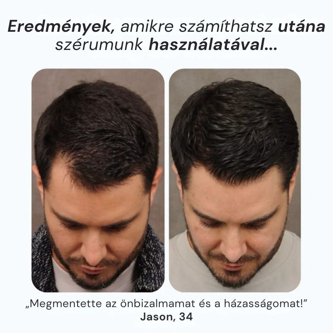 Daynava™ Roll-On a hajnövekedésért