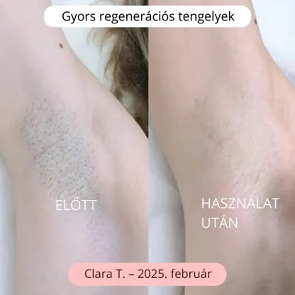 Daynava™ 5 az 1-ben Elektromos Borotva (HU)