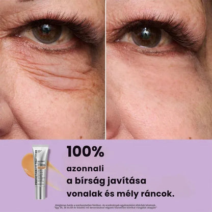 Daynava™ Azonnali Szemkörnyék-Lifting