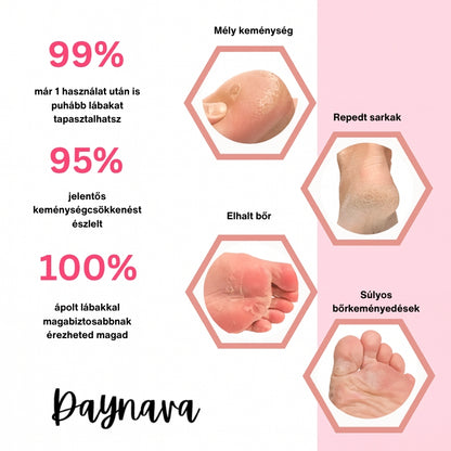 Daynava Elektromos Lábreszelő